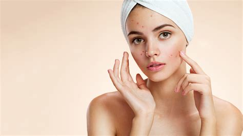 Discover How The Right Masking Routine Can Help Acne