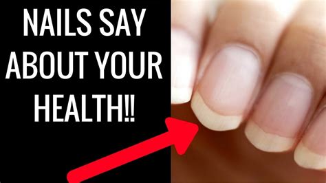 Fingernail Color Health 5 Things Your Nails Say About Your Health