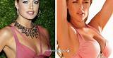 Celebrity Breast Augmentation Doctors Images