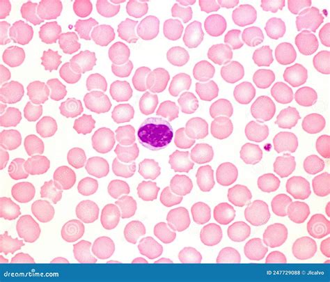 Human Blood Smear Monocyte Stock Photo Image Of Smear Leukocyte