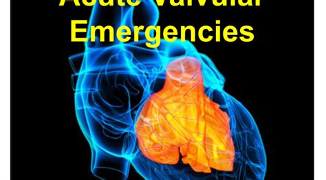 Emergency Medicine Educationscreen Shot 2017 01 05 At 919