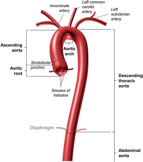 Aortopathies In Adult Congenital Heart Disease And Genetic Aortopathy