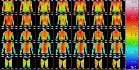 Thermographic Skin Surface Temperature Distribution Of Chest