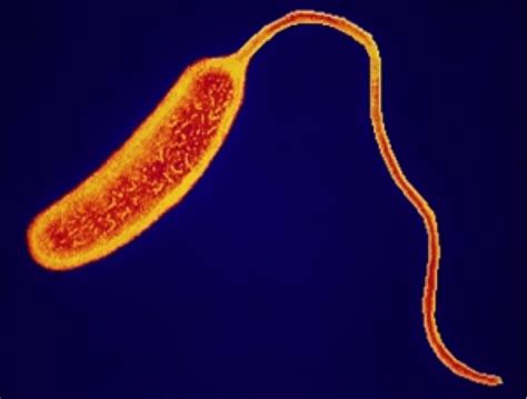 Cholera A Deadly Disease