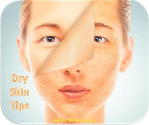 Dry Skin Tips Dry Skin Summer Perfect Summer Skin Summer Skin Care