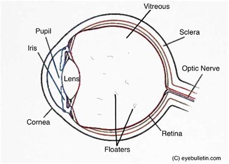 Floaters After Cataract Surgery Are Mostly Normal Eye Bulletin