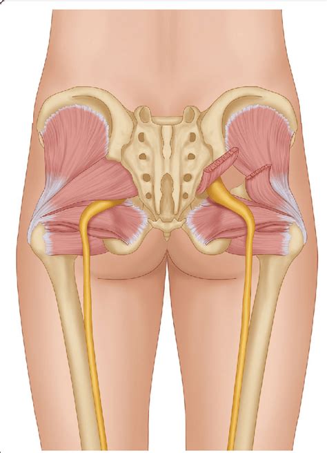 Illustration Of Displaying The Release Of The Piriformis Muscle On The