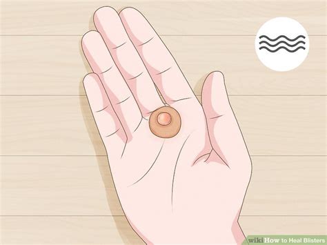 4 Ways To Heal Blisters Wikihow