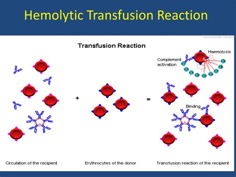 Ppt Adverse Reactions To Blood Transfusion Powerpoint Presentation