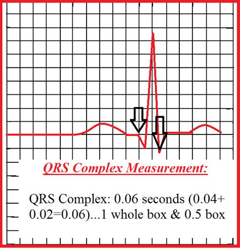 How To Measure A Qrs Complex On An Ekg Strip Qrs Complex Measurement