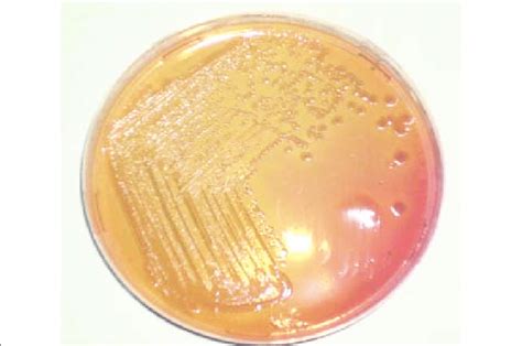 Non Lactose Fermenting Colonies On Macconkey Agar Download