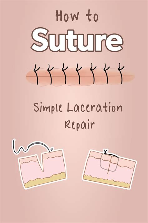 Learn How To Suture Like A Pro Suturing Np Nursepractitioner Pa Via