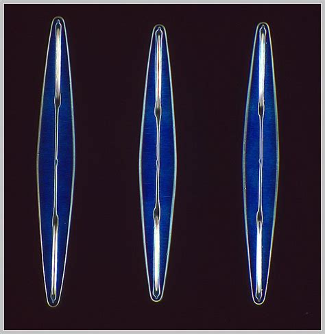 A Lindheimeri Picture Of Diatom Microscopic Nature Phytoplankton