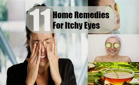 Home Remedies For Itchy Eyes