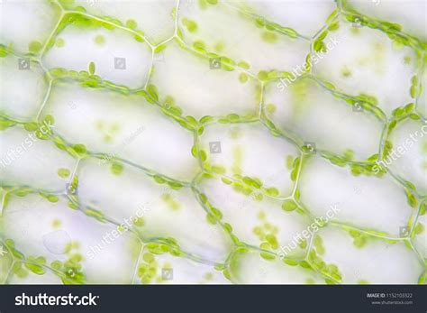 We did not find results for: Hydrilla Leaf Cell Under Light Microscope - Micropedia