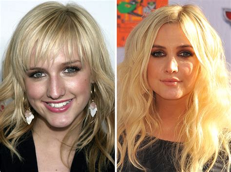 Ashlee Simpson Plastic Surgery Before And After Inspiring Your Life