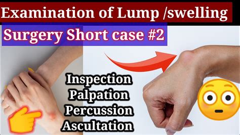 Examination Of Lump Swelling Surgery Short Case 2 Inspection