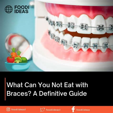What Can You Not Eat With Braces A Definitive Guide 2023