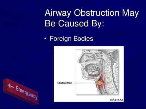 Airway Obstruction1