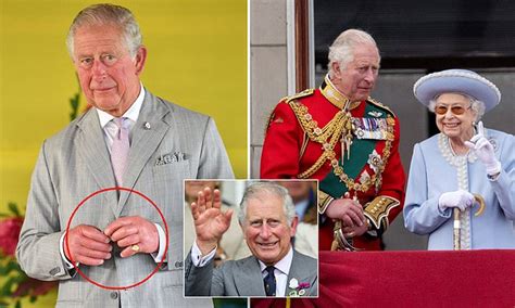 Doctor Reveals Why King Charless Fingers Are So Swollen Daily Mail