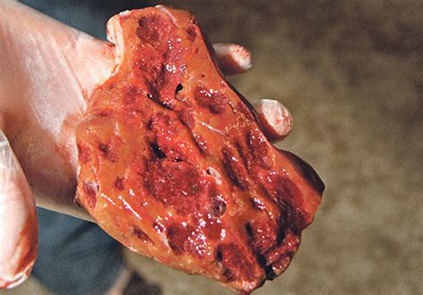 Liver fluke disease is a chronic parasitic disease of the bile ducts. New software could help detect liver fluke | The Western ...