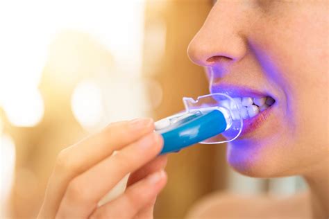 Teeth Whitening Are These 6 Methods Safe Eden Rise Dental