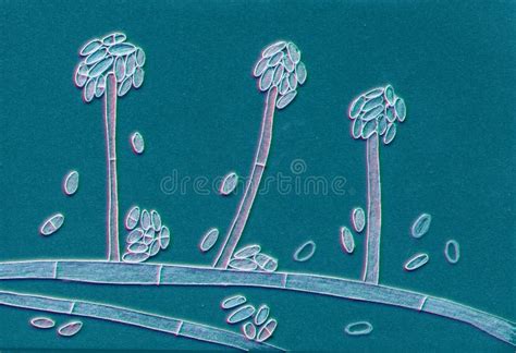 Acremonium Mould Fungus Illustration Stock Illustration Illustration