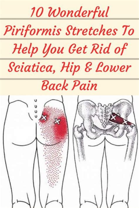 Pin On Back Pain