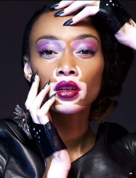 Winnie Harlow Black Models Vitiligo Winnie Harlow Americas Next Top