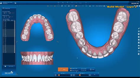 Steps Digital Orthodontic Software Dicaon D V Youtube