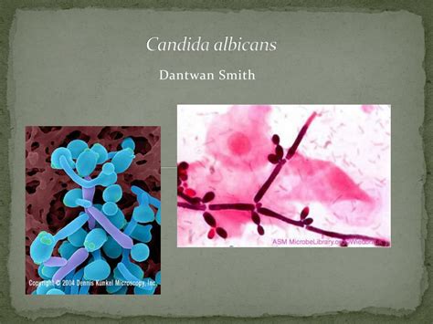 Ppt What Is Candida Albicans Powerpoint Presentation Free Download