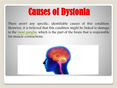 Ppt Dystonia Symptoms Causes And Treatment Powerpoint Presentation