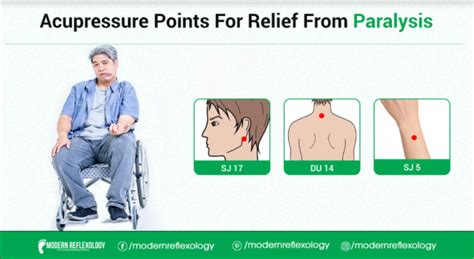 Acupressure Points For Treating Paralysis Modern Reflexology