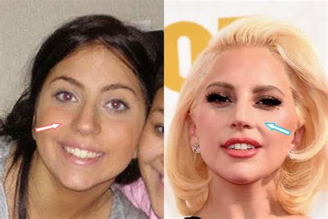 Lady Gagas Changing Nose Has She Had A Job Justinboey