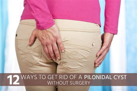 12 Ways To Get Rid Of A Pilonidal Cyst Without Surgery Pilonidal Cyst