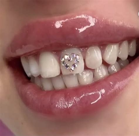 Heart Teeth Gems Tooth Gem Teeth Jewelry Dental Jewelry