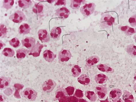 Neisseria Gonorrhoeae Gram Stain