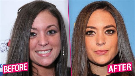 Jersey Shore Casts Shocking Plastic Surgery Transformations Revealed