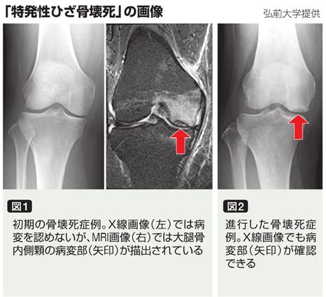記事一覧 - アピタル（医療・健康・介護）：朝日新聞デジタル