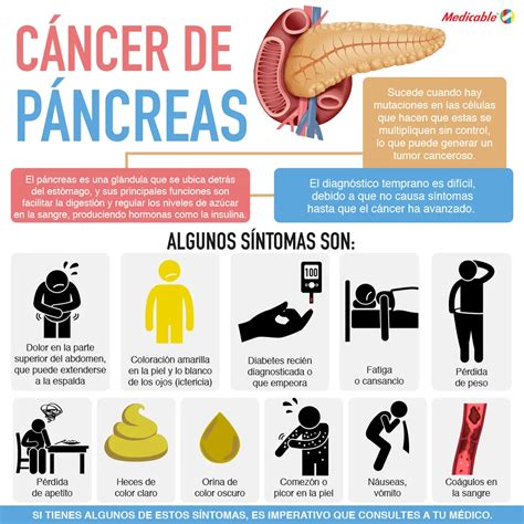 Cáncer De Pancreas Medicable
