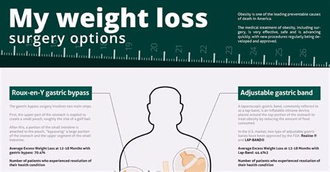 Best Weight Loss Surgery Options Weightlosslook