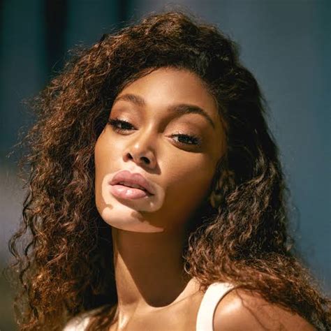 Winnie Harlow Biography Real Name Age Height Parents Siblings