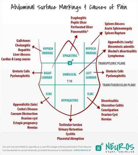 Abdominal Areas For The Love Of Nurses Pinterest