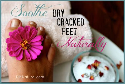 Dry Cracked Feet Can Be Soothed Naturally In 3 Easy Steps