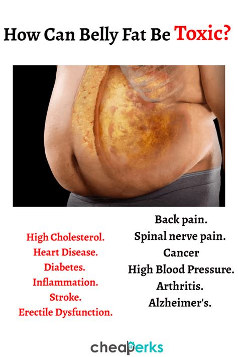 Upper belly fat and lower belly fat. The Secret to Lose Belly Fat without Exercise NATURALLY ...