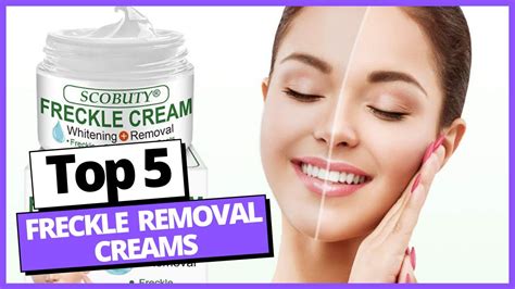 Best Freckle Removal Creams 2021 Skin Perfecting Youtube