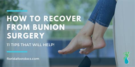 How To Recover From Bunion Surgery 11 Tips That Will Help Foot