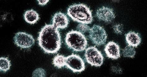 How The Coronavirus Short Circuits The Immune System The New York Times