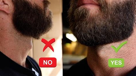 how do i stop my beard from growing on my neck fabalabse