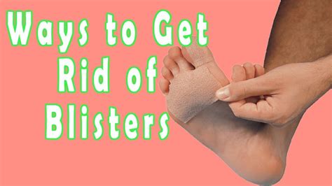 How To Get Rid Of Blisters Ways To Get Rid Of Blisters Youtube